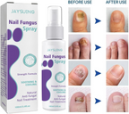 Extra Strong Nail Fungus Treatment Spray - 100ml