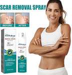 South Moon  Scar Spray